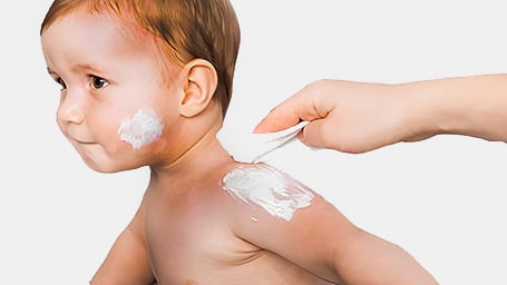 atopichnaya-kozha-deti-min